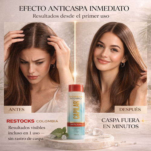 Tratamiento Intensivo Anticaspa